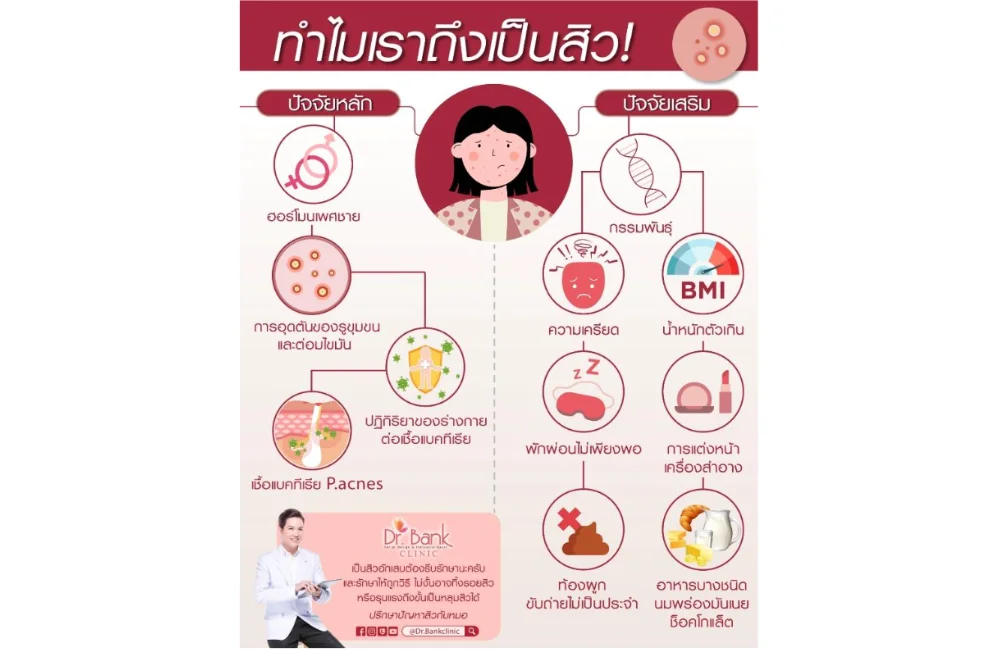 สาเหตุของการสิวอักเสบ