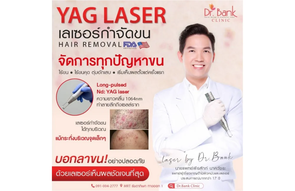 เลเซอร์กำจัดขนด้วย YAG Laser