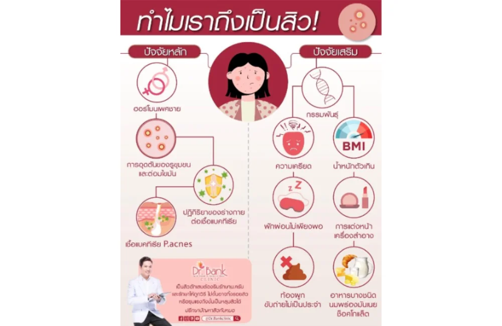 สาเหตุของการเกินสิว